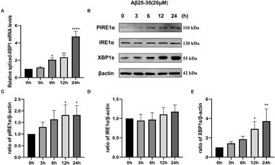 IRE1α-XBP1 Affects the Mitochondrial Function of Aβ25–35-Treated SH-SY5Y Cells by Regulating Mitochondria-Associated Endoplasmic Reticulum Membranes